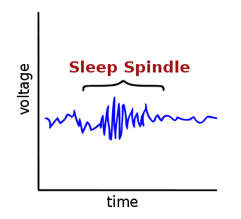 The Profound Interplay Between Sleep and Cognitive Function