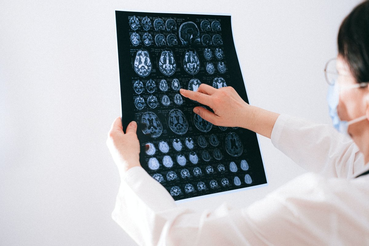 Clinician Guide to Patient Conversations on Brain Health