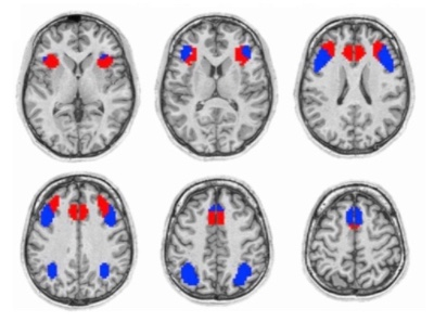 Brain Imaging and Intelligence | Creyos