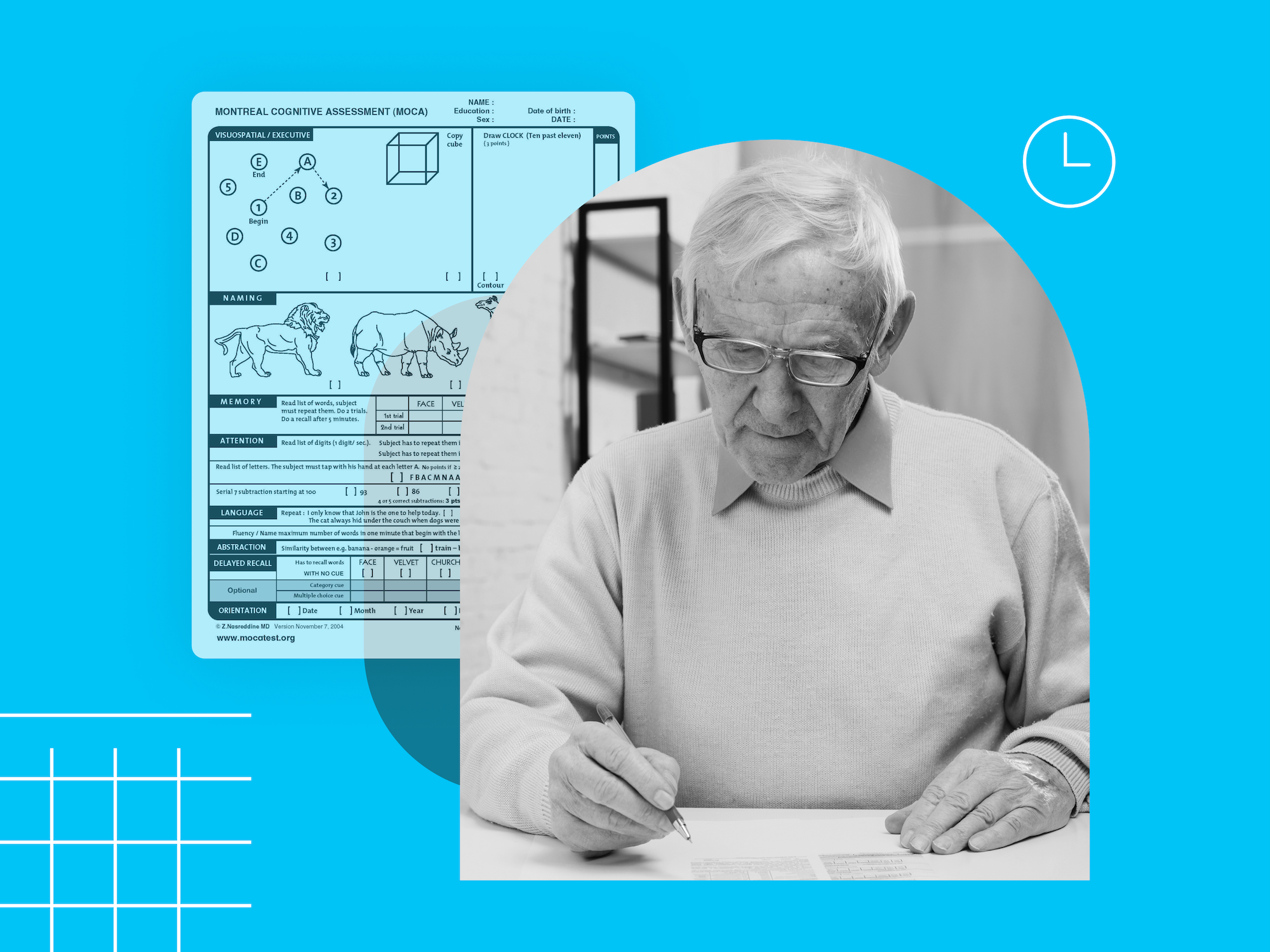 Beyond the MoCA Test: How to Improve Early Dementia Detection